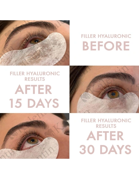 Botox Hyaluronic Lash & Brow serum| Kalentin Sustainable Lash Brand
